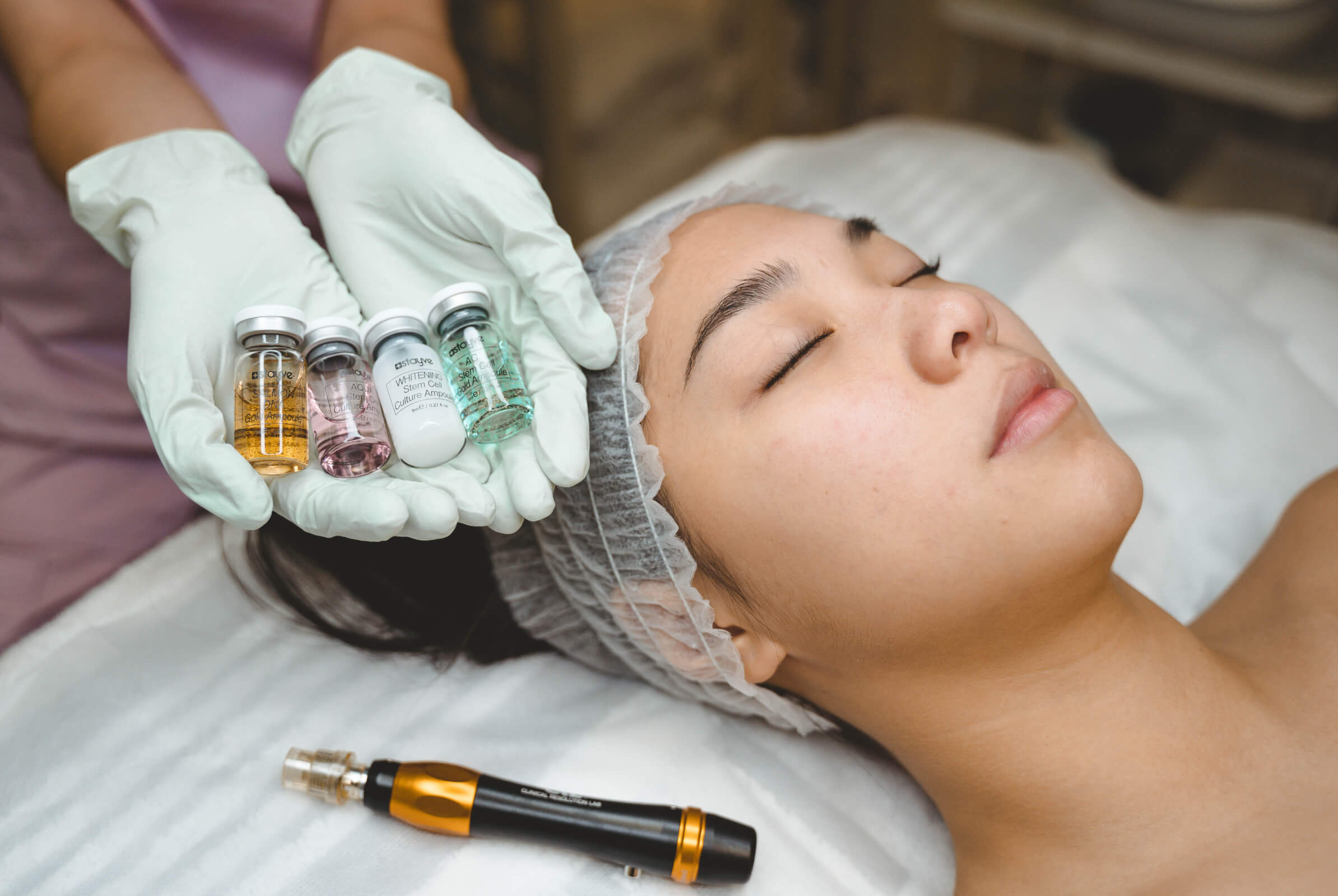 Microneedling